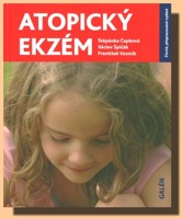 Atopický ekzém